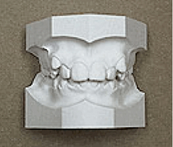 plaster_teeth_model